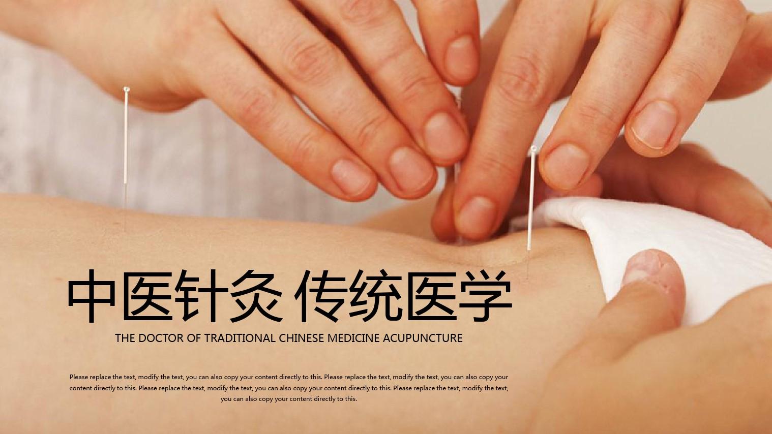 传统中医针灸
