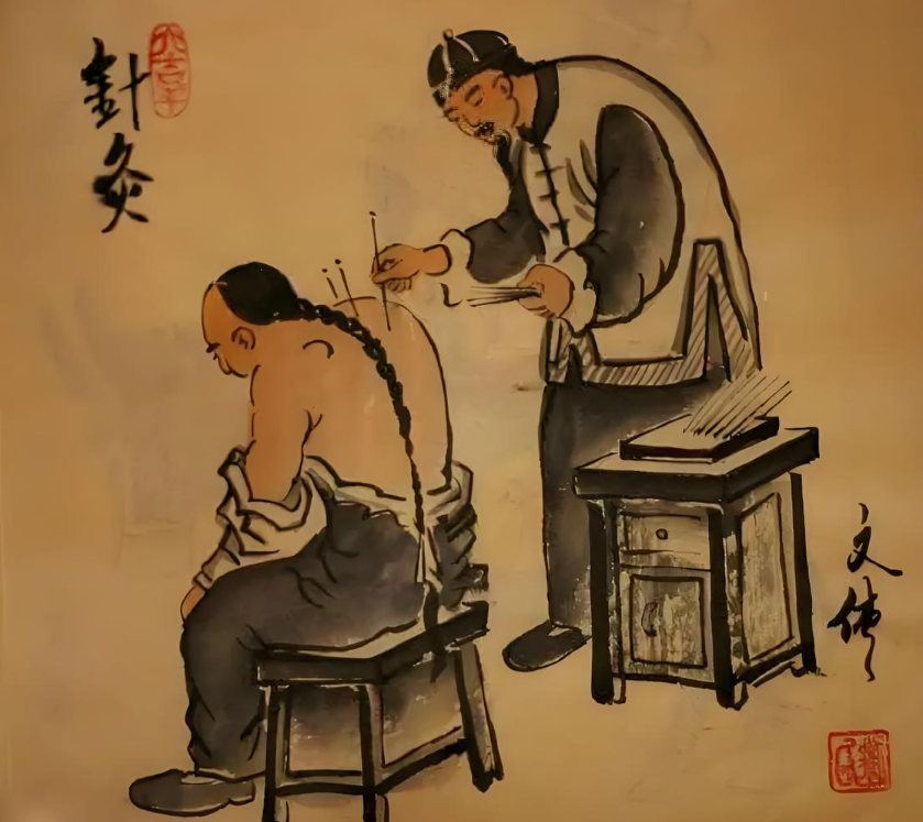中医针灸