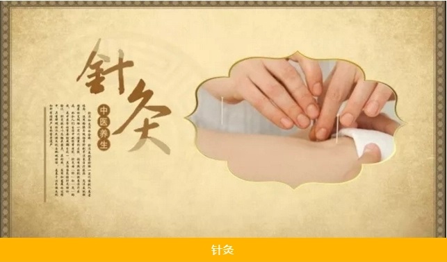 针灸治疗