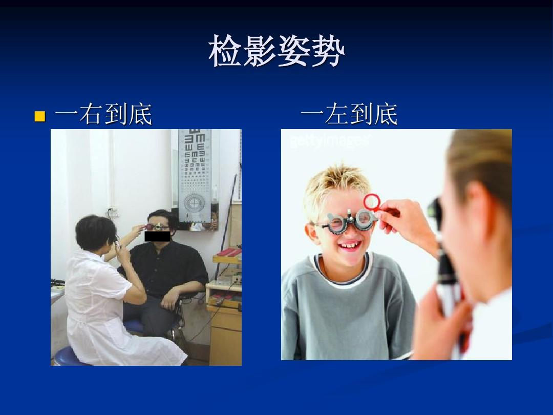 检影验光的优点