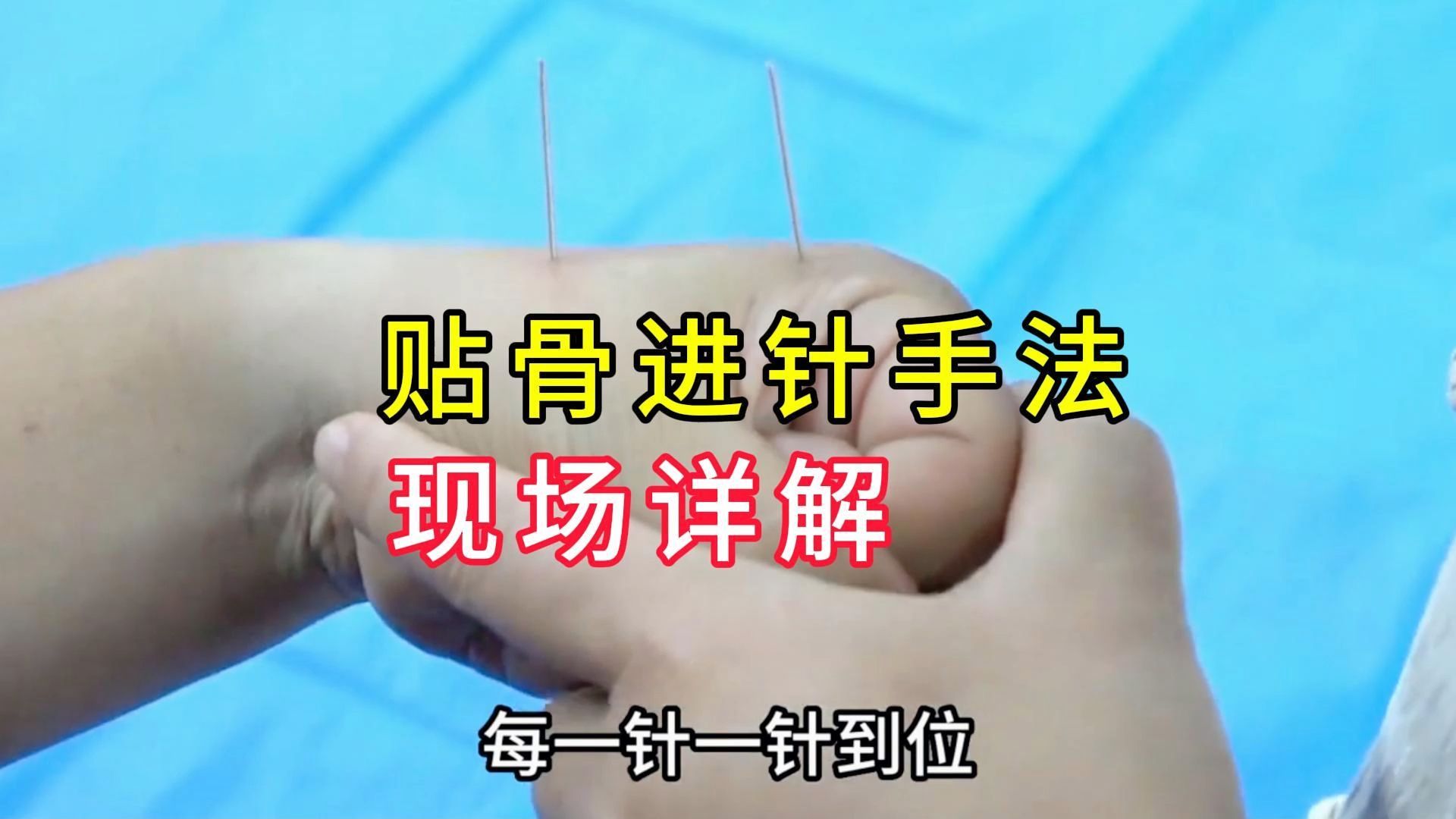 中医针灸培训