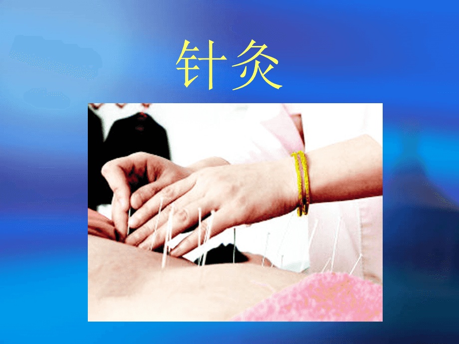 中医针灸技术培训机构推荐