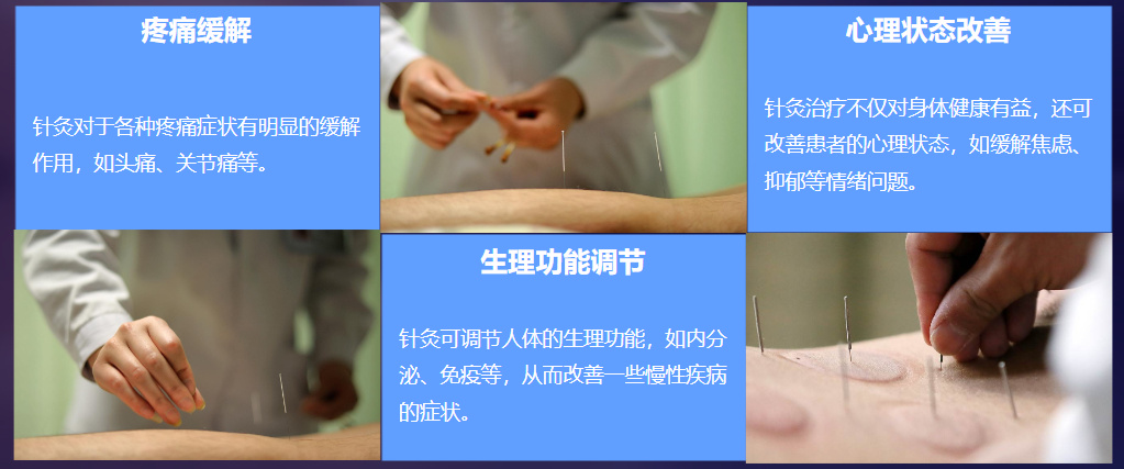 中医针灸培训内容
