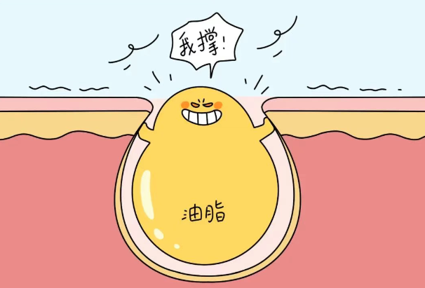 快来看真！能缩小毛孔的办法
